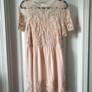 Lace Forever 21 Dress